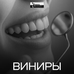 Виниры от