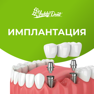 Имплантация