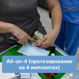 Имплантация All-on-4, протезирование на 4 имплантах