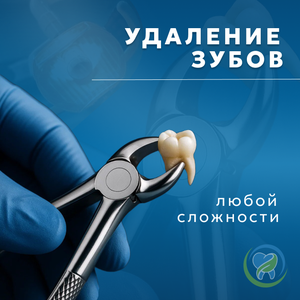 Удаление зубов 