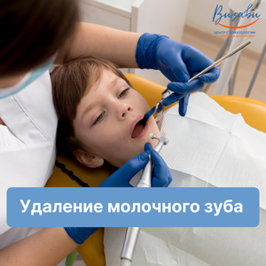 Удаление молочного зуба простое