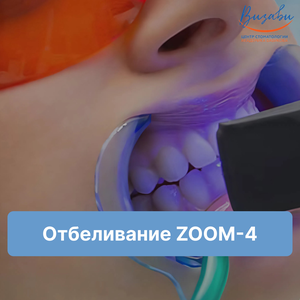 Отбеливание зубов ZOOM-4