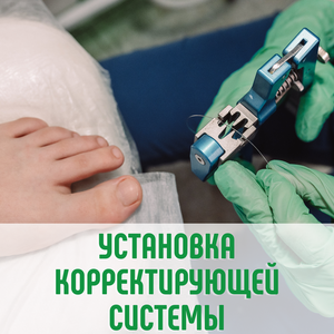 Установка корректирующей системы первично