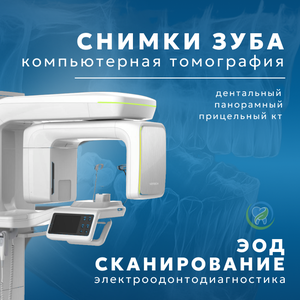 Снимок зуба КТ, ЭОД