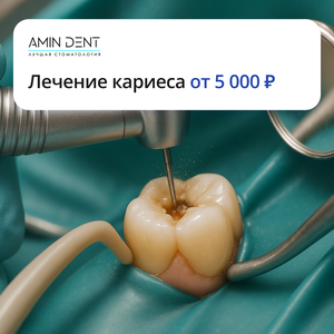 Лечение кариеса