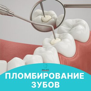 Восстановление зуба от