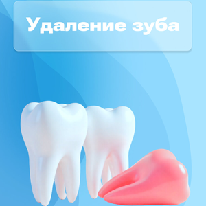 Удаление зуба от 3500