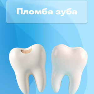 Пломба на зуб от 5900