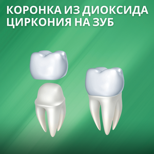 Коронка из диоксида циркония на зуб