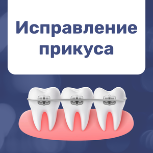 Выравнивание зубов брекетами