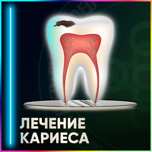 Лечение кариеса