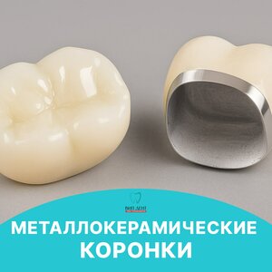 Металлокерамические коронки от 
