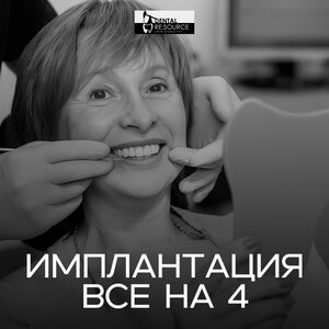 Имплантация все на 4 от