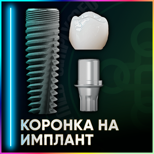 Коронки из циркония на имплантат