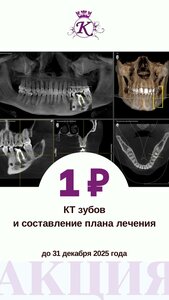 Консультация врача стоматолога+ Кт зубов = 1р.