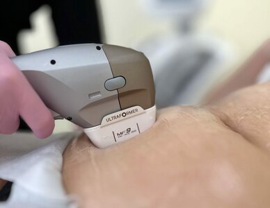 SMAS-лифтинг тела на аппарате ULTRAFORMER