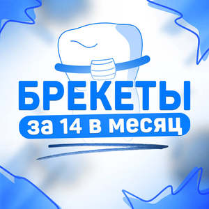Исправление прикуса брекетами