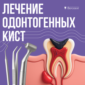 Лечение одонтогенных кист от