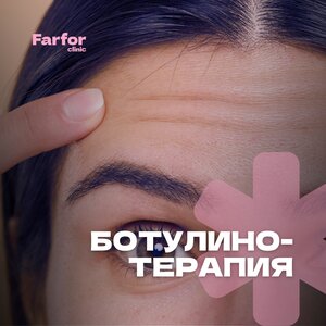 Ботулинотерапия