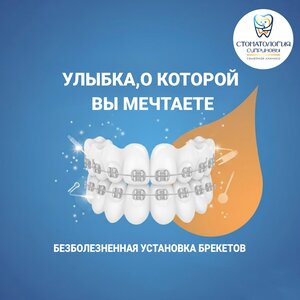 Установка брекетов