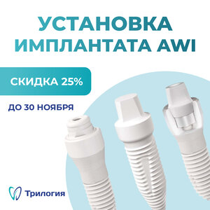 Установка импланта AWI —Скидка 25% — м.Сокол