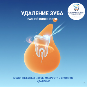 Удаление зуба 