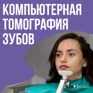 Компьютерная томография зубов