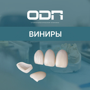 Виниры от
