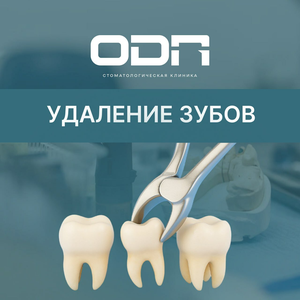 Удаление зуов от