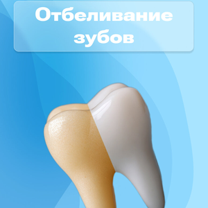 Отбеливание зубов 12900