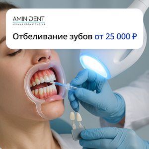 Отбеливание зубов