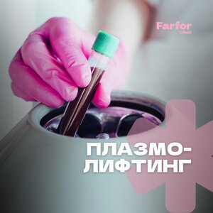 Плазмолифтинг (PRP-терапия)