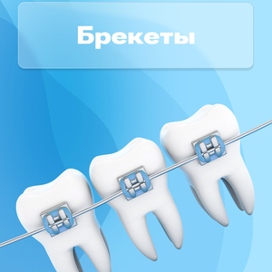 Брекеты от 49000