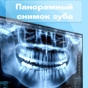Снимок зубов 1400