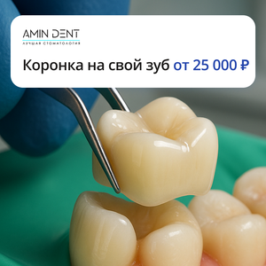 Коронка на свой зуб