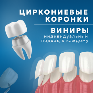 Циркониевые коронки и виниры