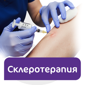 Склеротерапия