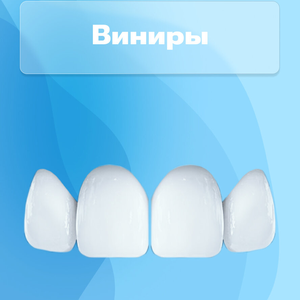 Виниры от 27900