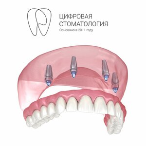Протезирование All-on-4 (хирургическая часть) - 1 челюст