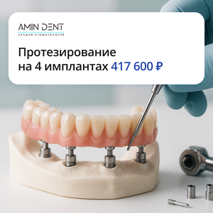 Протезирование All-in-4