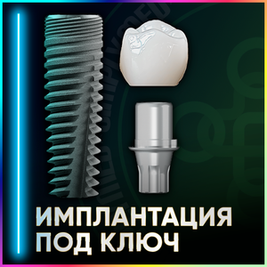 Имплантация зубов под ключ