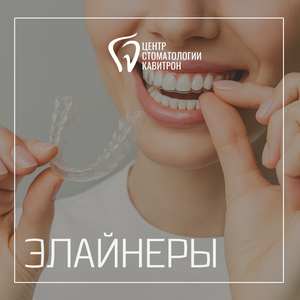 Элайнеры от