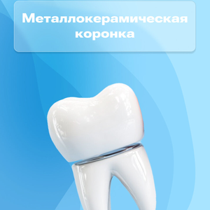 Металлокерамическая коронка от 10900