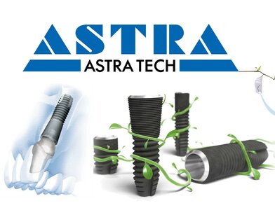 Имплантация Astra-tech