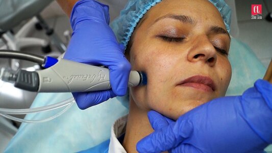 Гидропилинг HydraFacial
