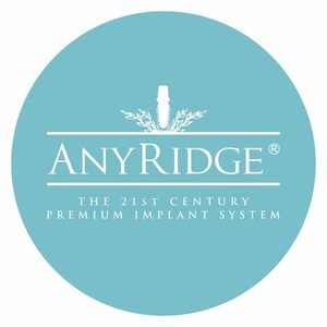Имплантация зубов "AnyRidge"