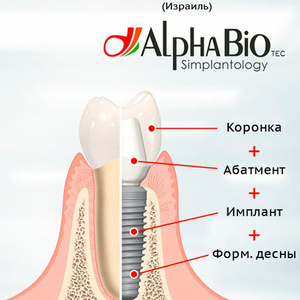 Имплант Alpha Bio - "под ключ"