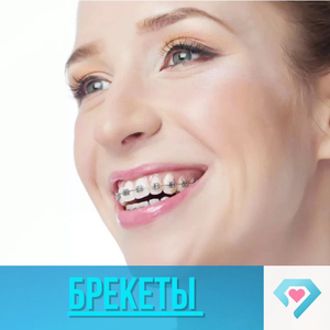 Брекеты