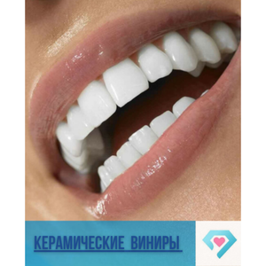 Керамические виниры E-max 