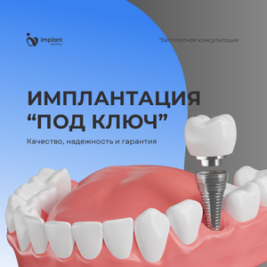 Имплантация под ключ!